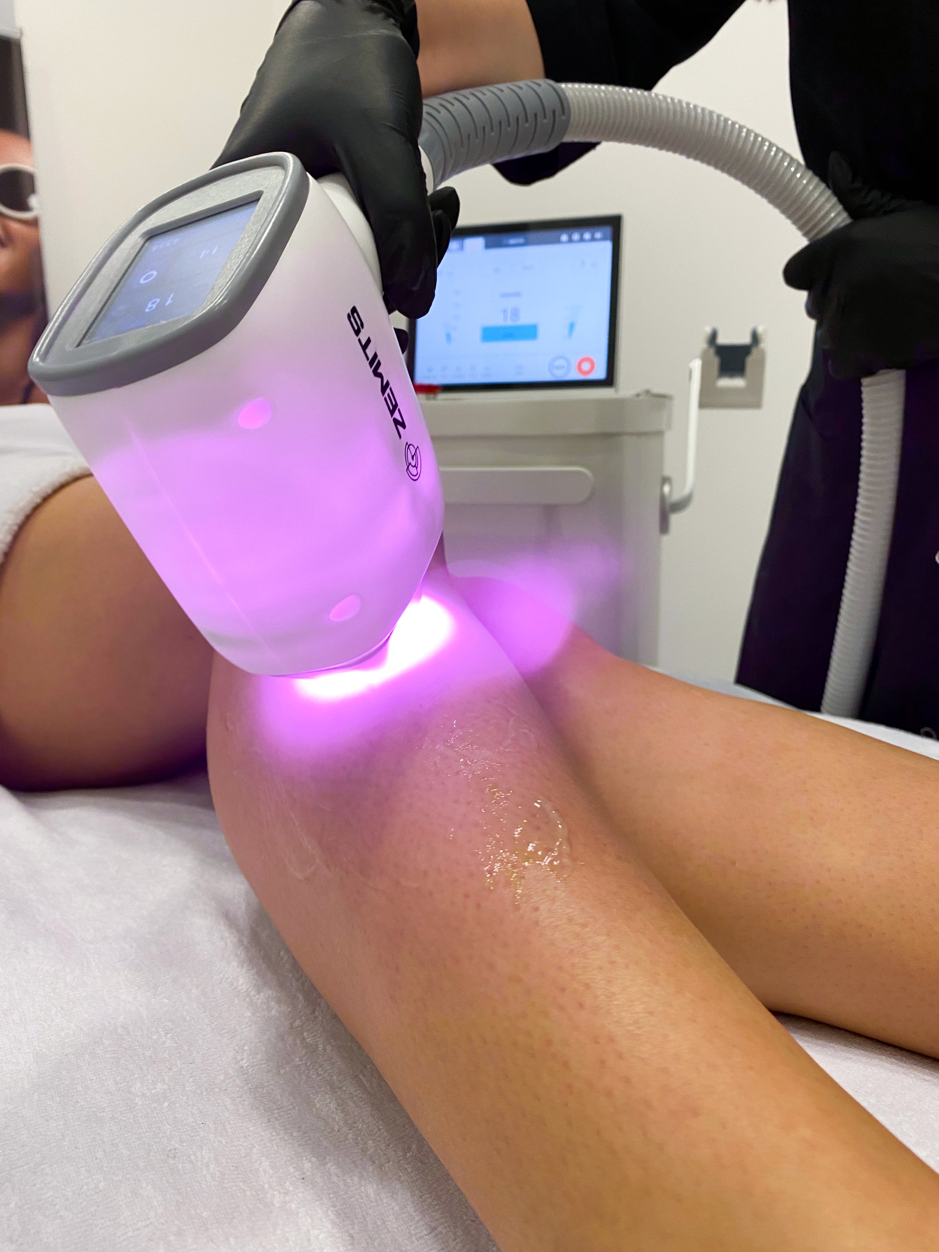 Permanent Laser Hair Removal HELLO GORGEOUS